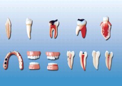 牙齿病变系列模型Bk-L1012
