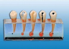 牙髓病临床模型Bk-L1011