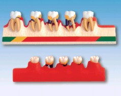 牙周病分类模型Bk-L1010