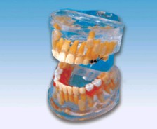 透明乳牙发育模型Bk-L1009