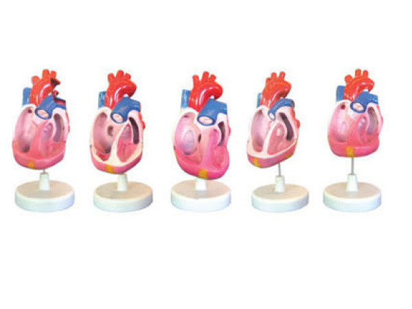 先天性心脏畸形模型（5部件）