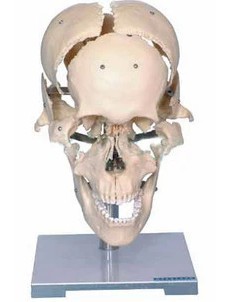 颅骨骨性分离模型